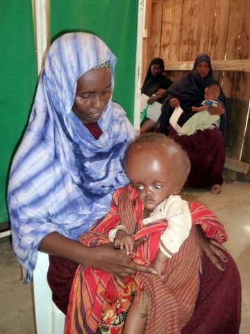Summer2011 - Somalia mother and HC child